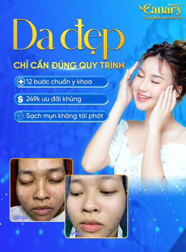 LẤY NHÂN MỤN 12 BƯỚC - GIẢI CỨU LÀN DA CHỈ VỚI 249K
