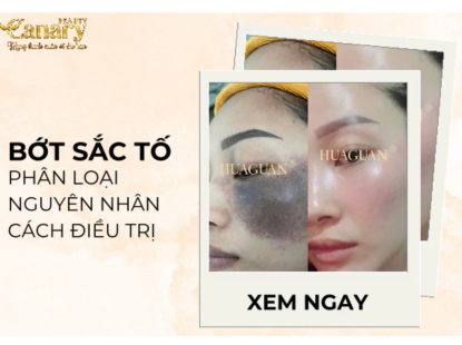 Điều Trị Bớp Sắc Tố
