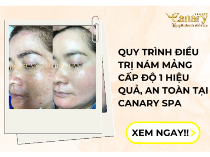 Điều Trị N&aacute;m